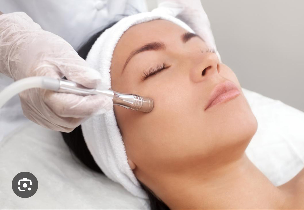 Dermabrasion Facial